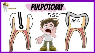 PEDIATRIC DENTISTRY  PULPOTOMY  Types Indications Procedure [upl. by Enrahs]