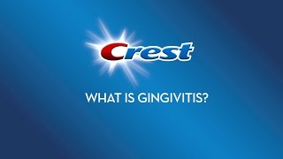 What is Gingivitis  Crest [upl. by Anoik]