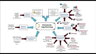 Unilateral Leg Swelling  OSCE [upl. by Ecital]