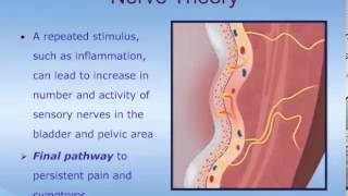 Understanding Interstitial Cystitis ICPainful Bladder Syndrome PBS [upl. by Adnilra517]