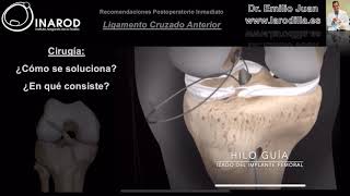 Ligamento Cruzado Anterior Cirugía y Recuperación Postoperatoria [upl. by Aser]