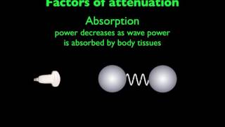 Ultrasound Physics Attenuation [upl. by Driskill380]