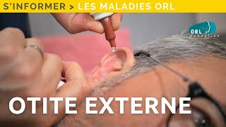 Comment guérir une otite externe  Maladie symptômes traitement [upl. by Pardner]