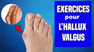 HALLUX VALGUS  TRAITEMENT ET EXERCICES KINÉ [upl. by Anaela]