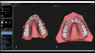 Carestream 3600  CS Model Plus Orthodontic Software [upl. by Schonthal]