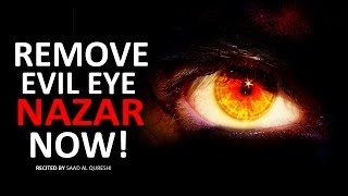 REMOVE EVIL EYE NOW  Very Powerful  MUST WATCH [upl. by Eladnwahs627]