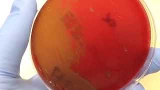 Microbiology  Hemolysis [upl. by Pergrim]