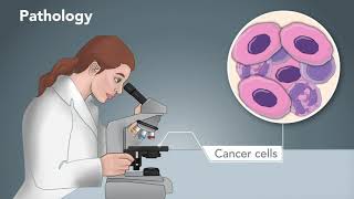 Graft rejection  Immunological basis of graft rejection [upl. by Easter]