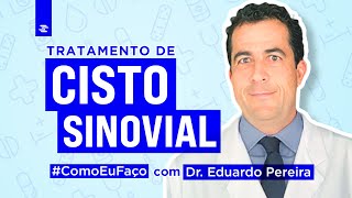 Como Eu Faço Tratamento de Cisto Sinovial com Dr Eduardo Pereira [upl. by Etz]