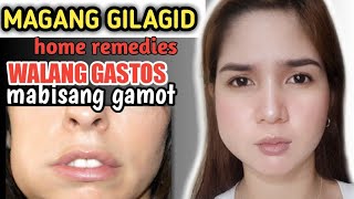 PAANO MAWALA ANG NAMAMAGANG GUMS o GILAGID  easy home remedies [upl. by Craw303]