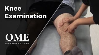 Knee Examination  Orthopaedics [upl. by Ovatsug]