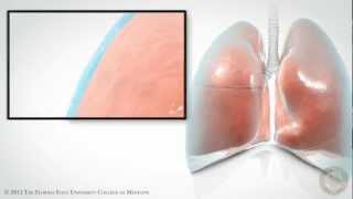 Pleural Space HD [upl. by Honeywell]