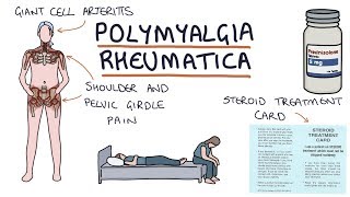 A Patient’s Guide to Understanding Rheumatoid Arthritis Pain [upl. by Fredra]