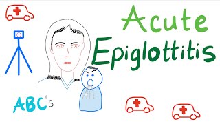 Acute Epiglottitis  Causes Symptoms Diagnosis and Management [upl. by Nashom]