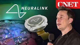 Elon Musk’s Neuralink Event Everything Revealed in 10 Minutes [upl. by Hardden206]