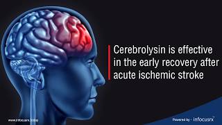 Cerebrolysin is effective in the early recovery after acute ischemic stroke [upl. by Teufert311]