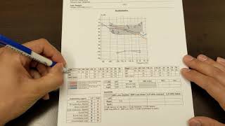 How to Read Your Hearing Test [upl. by Nadnarb739]