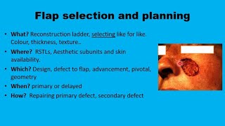 11 Facial flaps The Basics [upl. by Frederico]