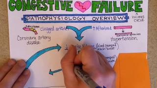 Congestive Heart Failure Pathophysiology [upl. by Jaynell]